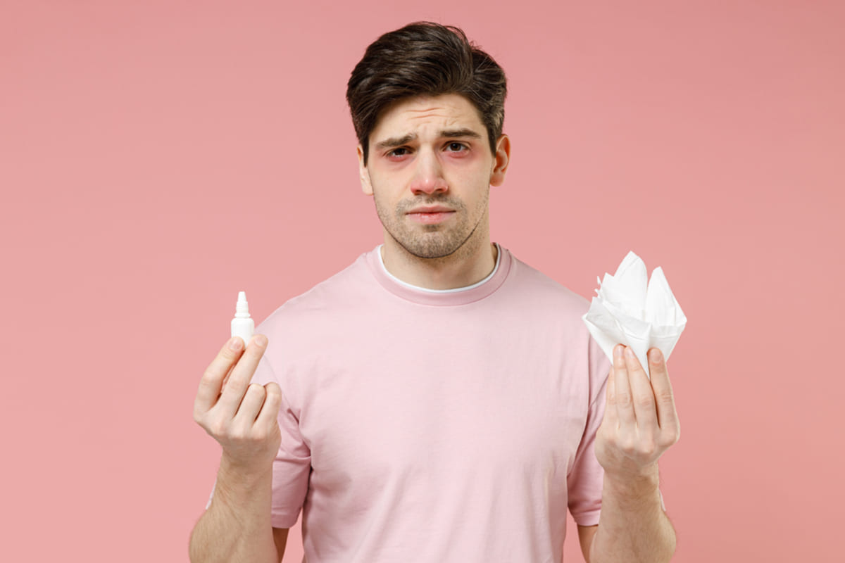 A man with red eyes and a red nose, showing symptoms of bad allergies, pet policies concept.